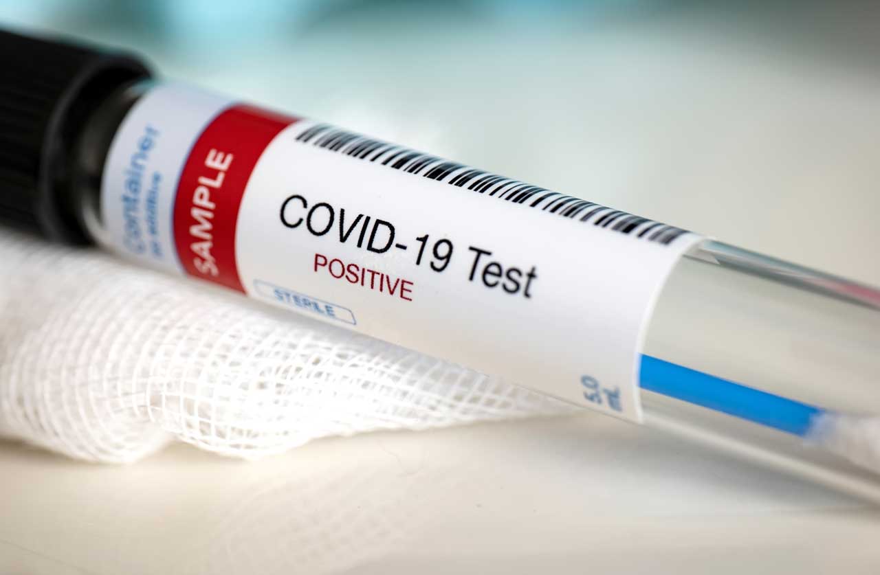 Entrega LUMO módulos de detección y tratamiento de Covid-19
